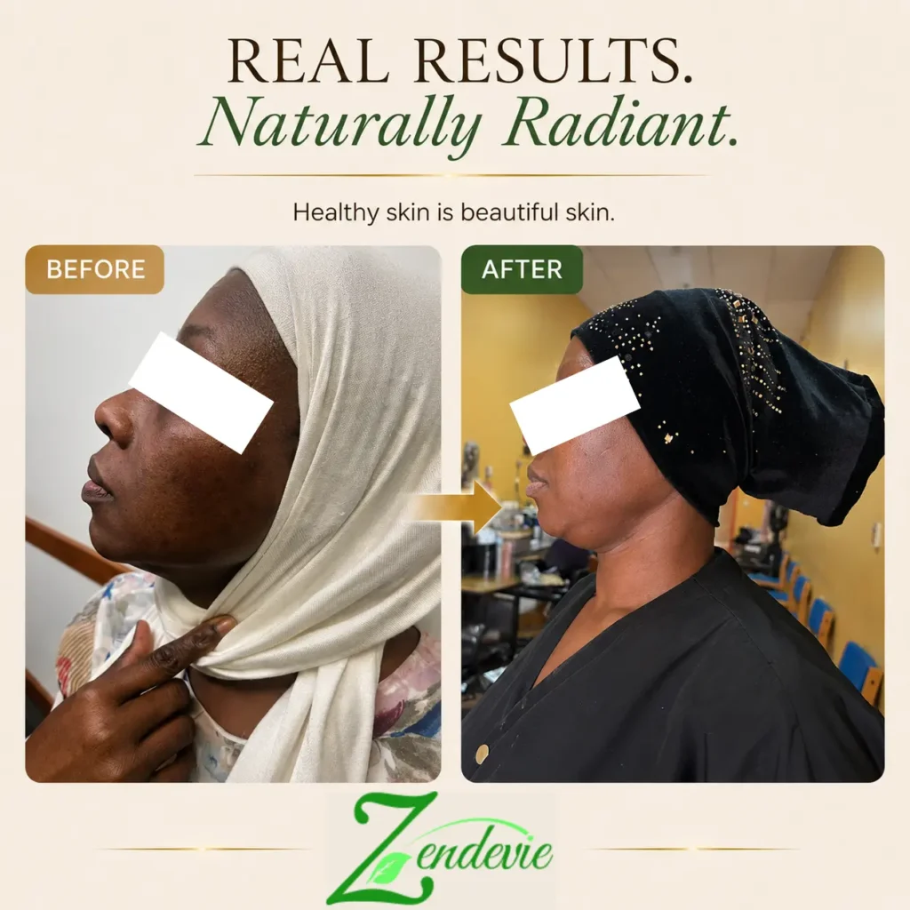 Zendevie before-and-after skincare result showing a deeper skin tone with a brighter-looking, more even-looking complexion.