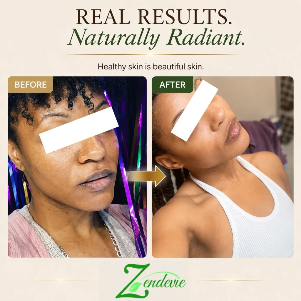 Zendevie before-and-after skincare result showing a smoother-looking, brighter-looking complexion with a healthy glow.