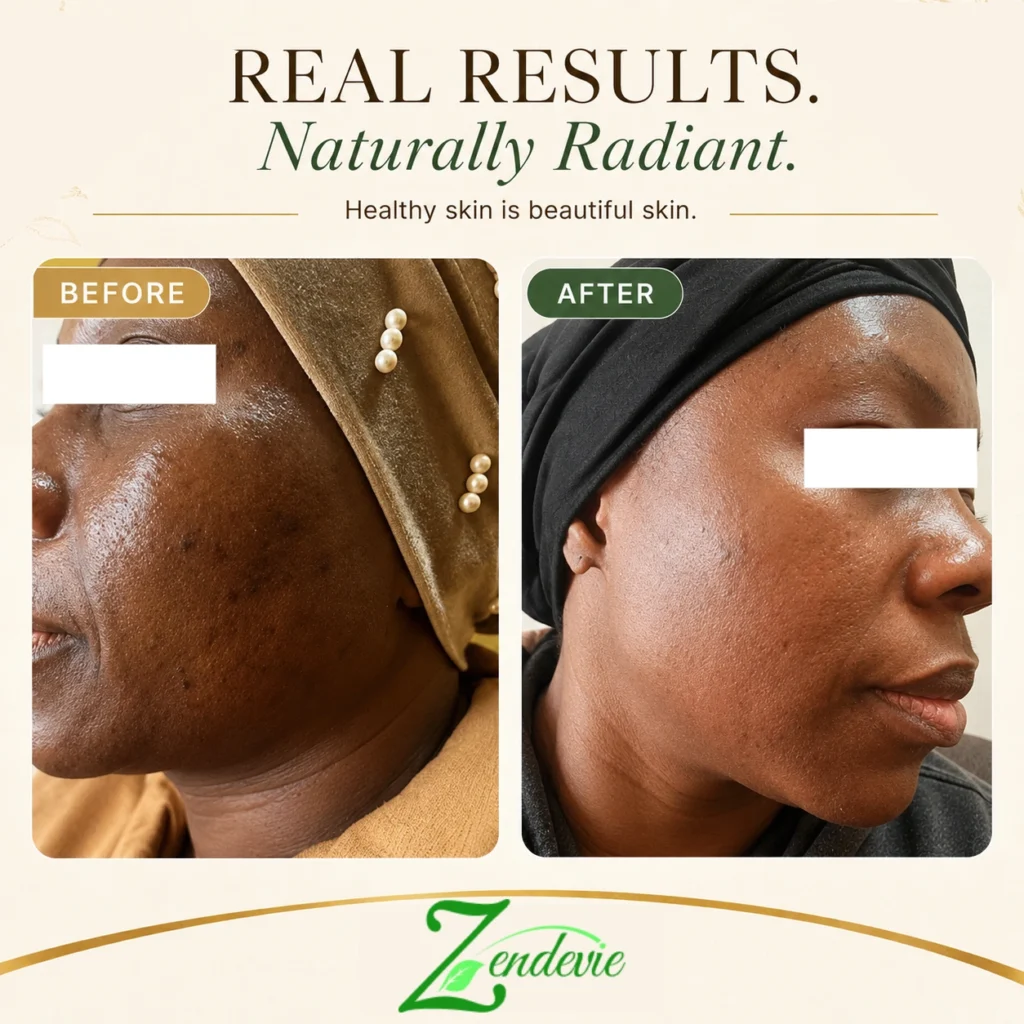 Zendevie before-and-after skincare result showing deeper skin with smoother-looking texture and a more radiant-looking complexion.