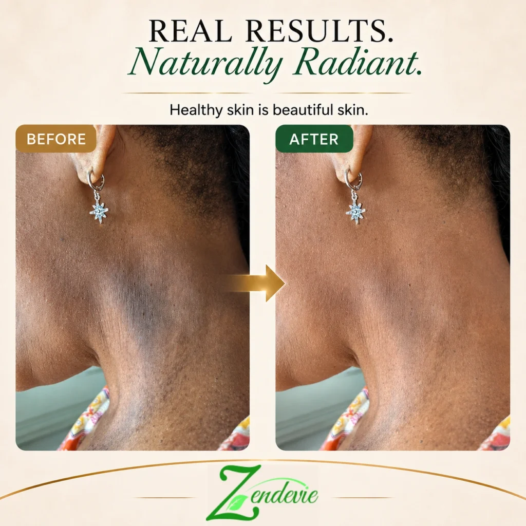 Zendevie before-and-after skincare result showing deeper skin with smoother-looking texture and a radiant complexion.