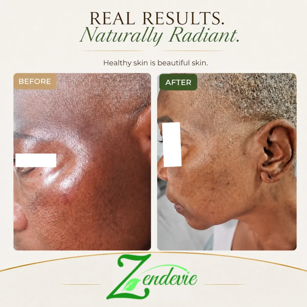 Zendevie before-and-after skincare result showing mature deeper skin with calmer-looking texture and a more even-looking complexion.