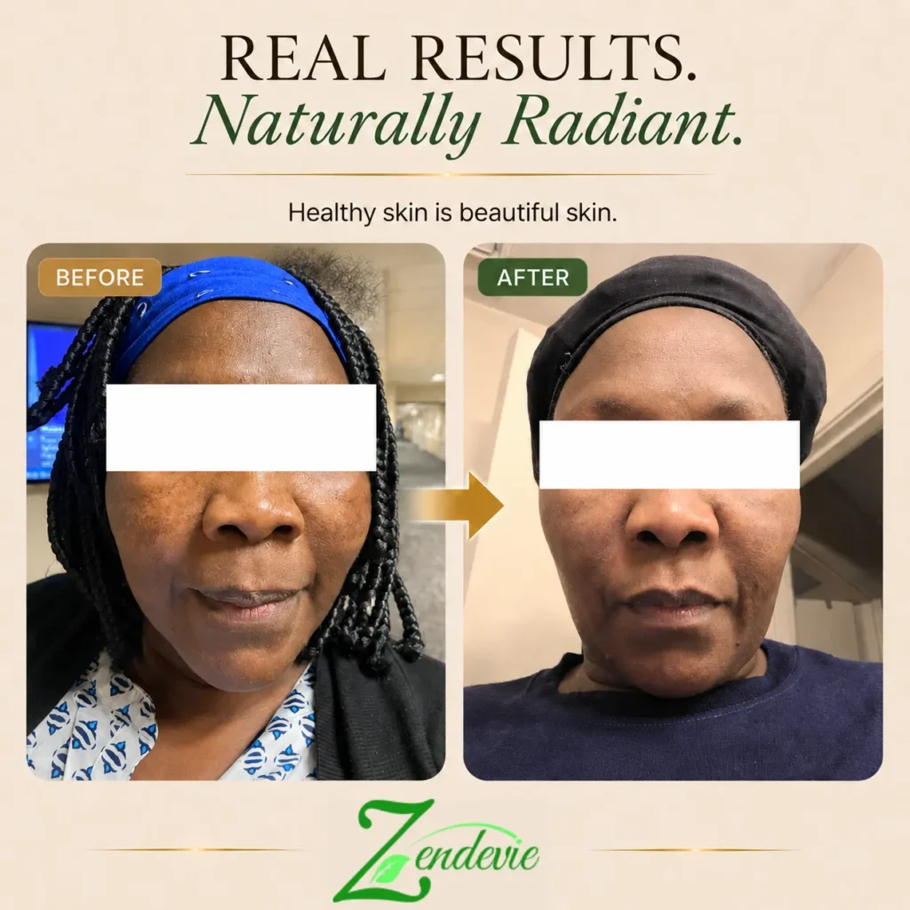Zendevie before-and-after skincare result showing mature deeper skin with a calmer, more even-looking complexion.