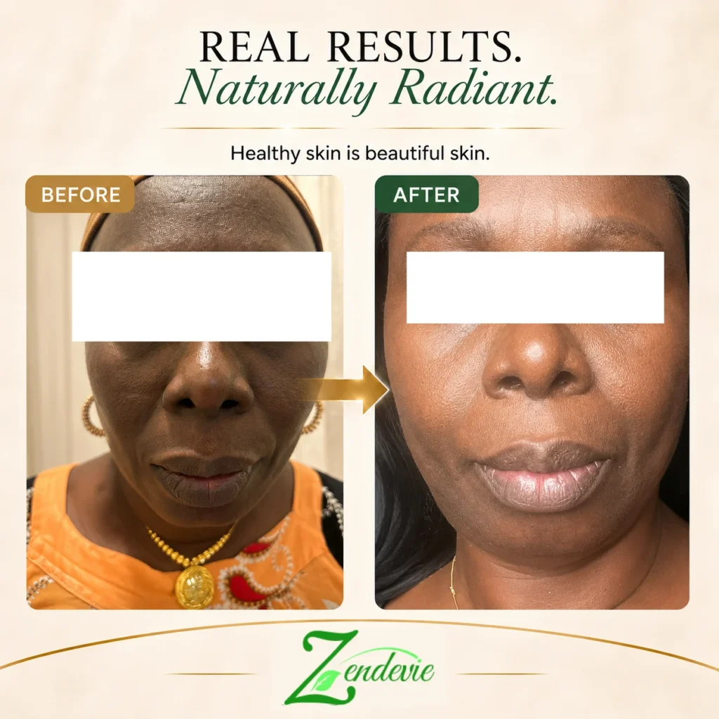 Zendevie before-and-after skincare result showing mature deeper skin with a brighter-looking, smoother-looking, more radiant complexion.
