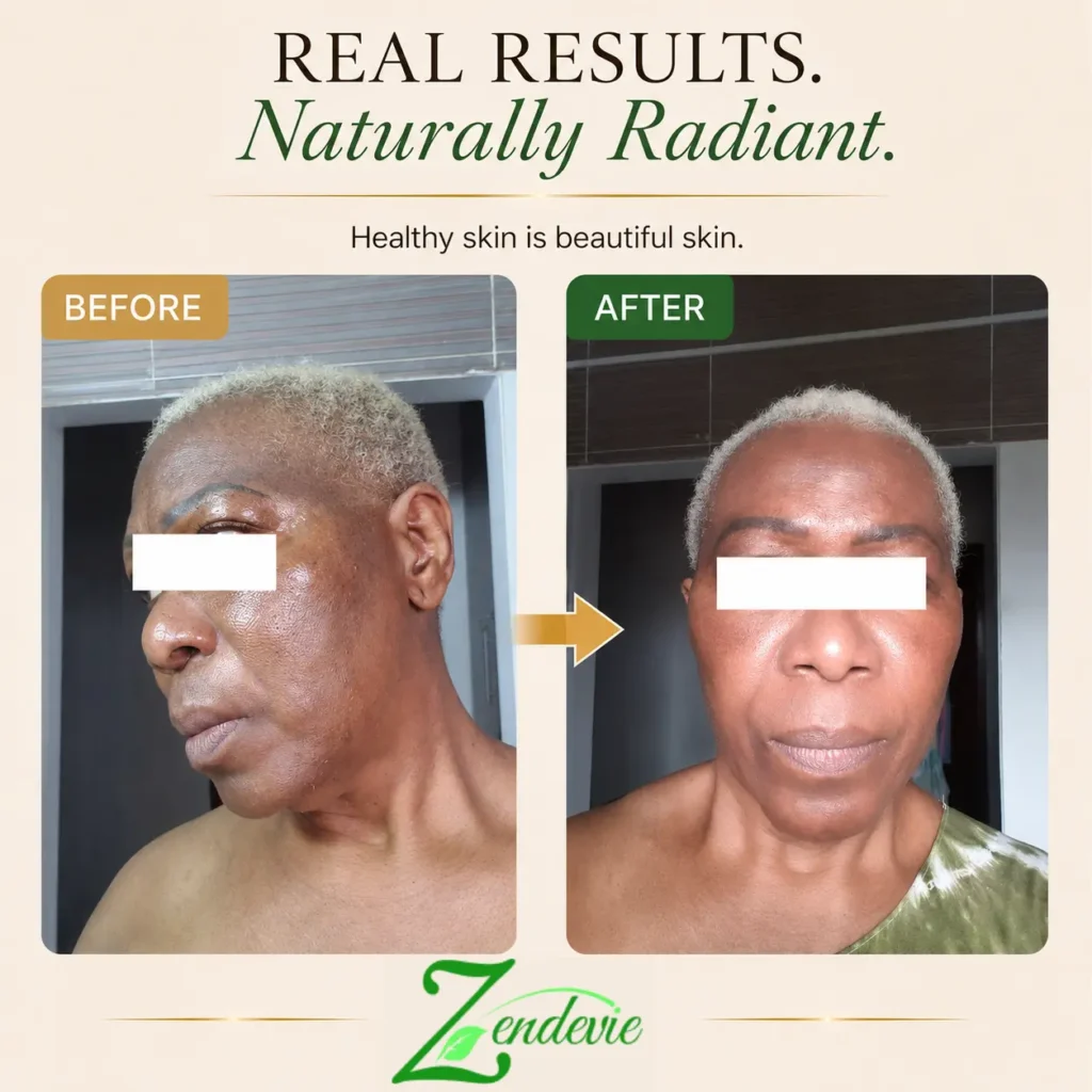 Zendevie before-and-after skincare result showing mature skin with a smoother-looking, more radiant-looking complexion.