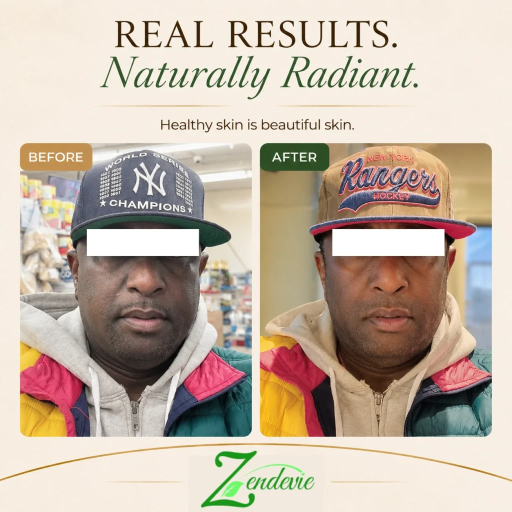 Zendevie before-and-after men’s skincare result showing a deeper complexion with smoother-looking, more even-looking, radiant skin.