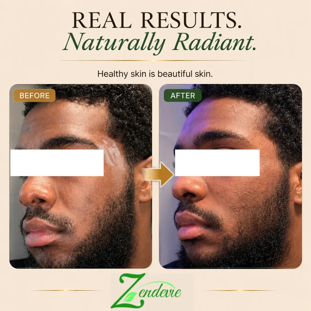 Zendevie before-and-after men’s skincare result showing smoother-looking, more radiant-looking skin on a deeper complexion.