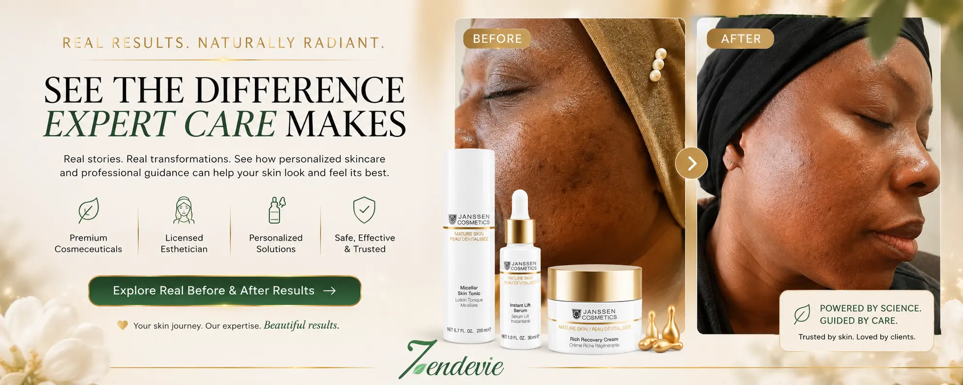 Shop Zendevie before-and-after skincare results banner featuring a client transformation and Janssen Cosmetics products.